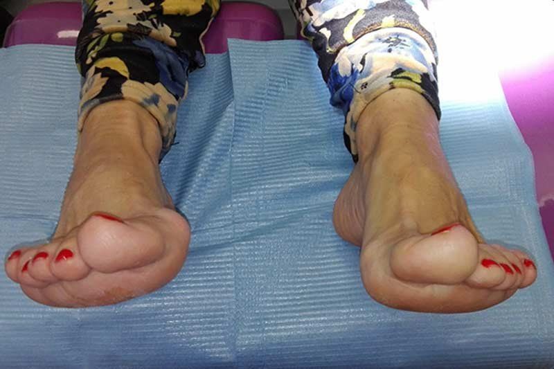 podología geriátrica